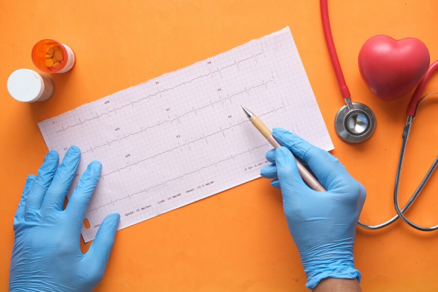 Healthcare professional checking ECG results